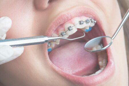 Braces Penrith