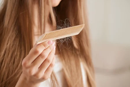 hair loss